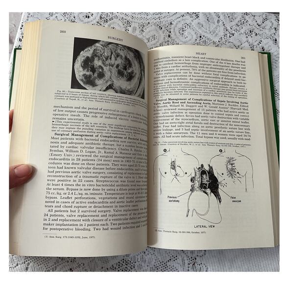 1972 Year Book of General Surgery: Vintage Medical Book Illustrated - Picture 5 of 6